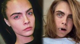 Cara Delevingne dişçi koltuğundan paylaştı: Çok ağladım